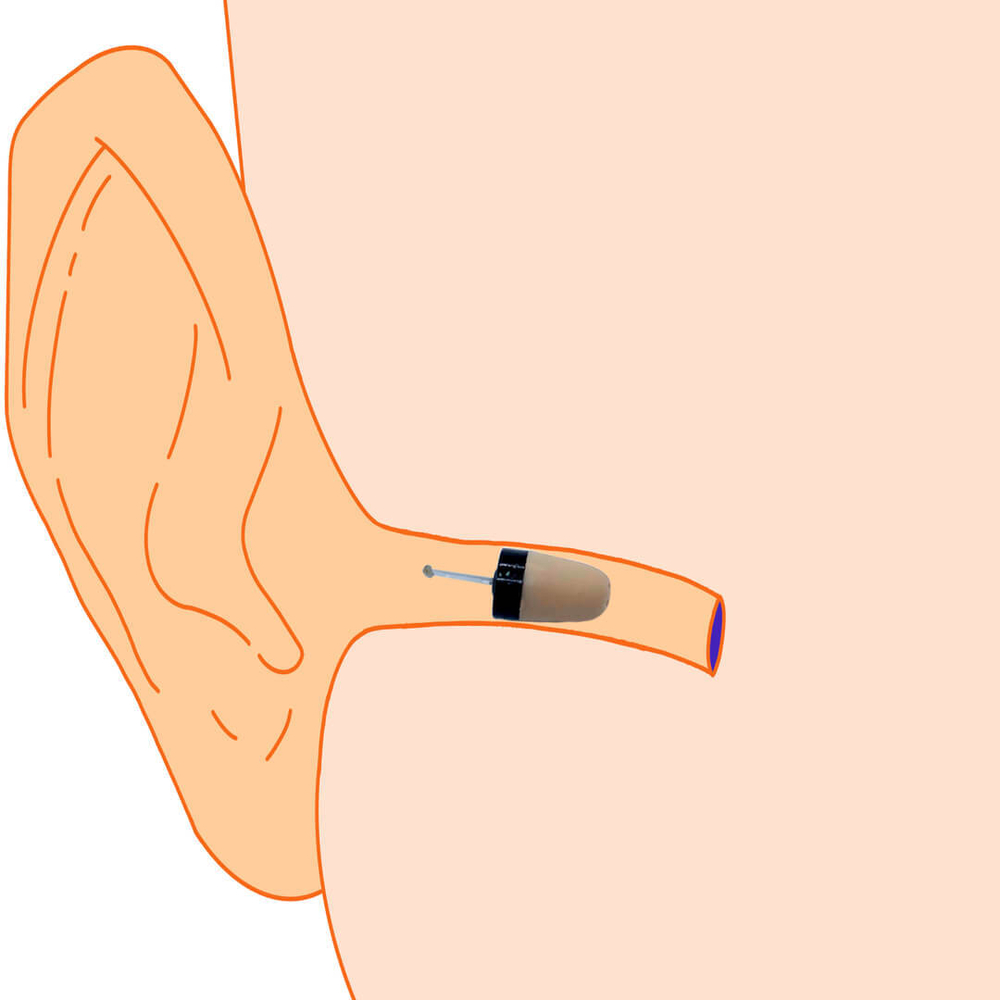 Микронаушник Nano City Капсульный Bluetooth